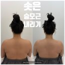 대호메디칼 | 구미웨딩관리추천,산동웨딩관리는 에이원뷰티에서
