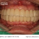 이스턴치과 네이버블로그