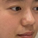 진주 에스테틱 모공레이저 후기ㅣ소솜에스테틱
