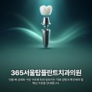 365서울탑플란트치과의원 | 여수치과 임플란트 치료 전 고려할 차이가 궁금하다면