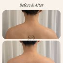 힐링케어 | 상도에스테틱 추천 린아르에스테틱 두피힐링케어 받고 온 후기