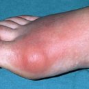 힐메디칼 이미지