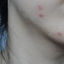 화목2통(남) | 황병태노니 헬스키니디톡스 자세한 리얼후기 에이스제이엠