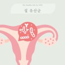 위시헬씨 여성 질유산균 추천 후기