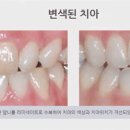 손고운치과의원 네이버블로그