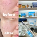 마산차량등록과 | 마산피부관리 제대로 찾았다! 조엘랑더마랩 솔직 압출 후기