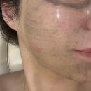케어마인 | 평택고덕피부관리 더마인에스테틱 맞춤 케어 받고 온 후기