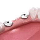 심플라인치과의원 이미지