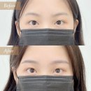 하루눈썹