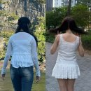 노원 팔뚝 무한람스 후기 | 7일차 붓기 변화, 세 번째 시술 받은 이유