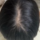 머리숱많아지는법 실천하고 빠지던 머리 멈춘 찐 후기
