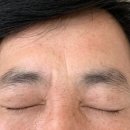 블리즈미