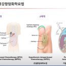 복막암, 복막내 전이 상황의 파이펙 시술, 하이펙 시술, 라이펙 시술의 차이점 이미지