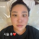 세븐일레븐 의정부센트럴타워점 | 의정부 피부관리, 뉴알라딘필링 &#34;스킨스토리&#34; 1차(알라딘필링)