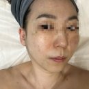 637 | 인천 연수구 고주파 리프팅 관리 추천 옥련동 유월왁싱 시그니처 관리 후기