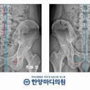 한양마디의원 네이버블로그
