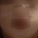 [다산에스테틱] 아이퀸 에스테틱 /내돈내산 9-12회차