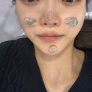 강남 선릉역 피부관리 뷰티크나인스킨앤왁싱 인생 첫 블랙헤드 집중케어 받은 후기