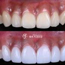 세라치과기공소 이미지