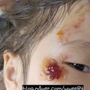 정동보건진료소 이미지