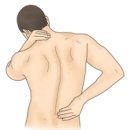 강직성 척추염(Ankylosing spondylitis) 이미지