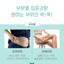 큰나래연합외과 네이버블로그