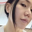 비쥬헤어 - 도봉구 | 이중턱 지방개선 주사 뉴비쥬 CA 주사 후기
