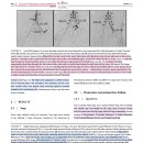 Caudal aorta와 aortic trifurcation에 발생한 thrombosis에 대한 stent 시술 이미지