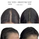 제이린헤어 - 전주시 완산구 세내로 291 | 부산탈모 고민 끝내는 자연커버! 제이린SMP