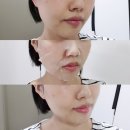 닥터스윌리 | 닥터스윌리 미라클 하이드라 트리트먼트 마스크팩