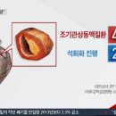 하루커피 네이버블로그