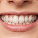 아리스 교정 치과기공소 | 성남 라미네이트 치과 선택 전 반드시 알아야 할 정보