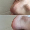 [파주-와동동] 여름철 필수관리 아기발로 재탄생한 운정 패디플래닝 "그로잉네일"