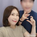 제제글로벌 | 피부과 시술 추천 받아 다녀온 히알루론산제제 스킨바이브 솔직후기