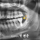 차오른치과의원 이미지