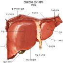 집에서 간을 청소 하는 방법 이미지