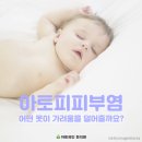 아토피피부염! 어떤옷이 가려움을 덜어줄까요? 이미지