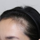 서울원효초등학교 | 후암동두피문신, 진짜 잘하는곳 가야 하는 이유 (후기 포함)