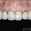 치아사랑치과기공소 이미지