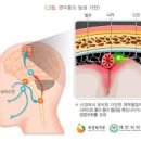 왼쪽 머리 통증 이유 6가지 이미지