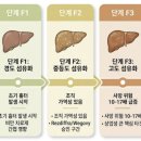 제이커브(j-curve) | MASH 치료제 시장 톺아보기: 단일 약물에서 병용·정밀치료 시대로