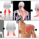 바디체인지 체형교정 이미지