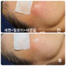 피부톡톡
