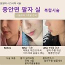 실리프팅, 무서운 시술일까? 실은 걱정보다 안전한 이유