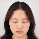 스칼프디자인센터마곡 이미지