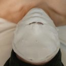 스완드 발산점 작은얼굴케어+아띨라 후기 (산후 광대 축소, 얼굴 비대칭 관리)