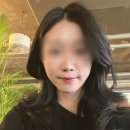 (주)엑셀온 | 신사역 피부과 이중턱주사 브이디파인 1회만에 효과 좋음 2주차 후기