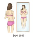 섭식 장애(Eating disorder) 이미지