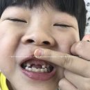 이수CDC어린이치과의원 네이버블로그