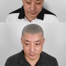 조헤어라인 이미지